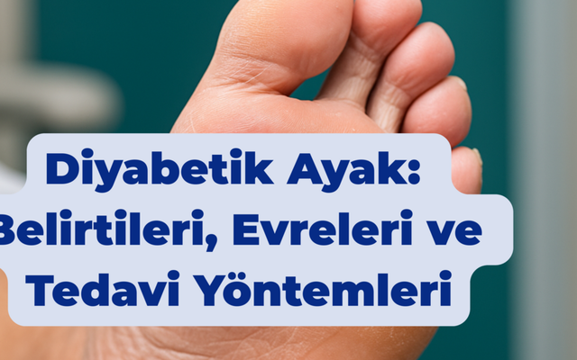 Diyabetik Ayak: Belirtileri, Evreleri ve Tedavi Yöntemleri