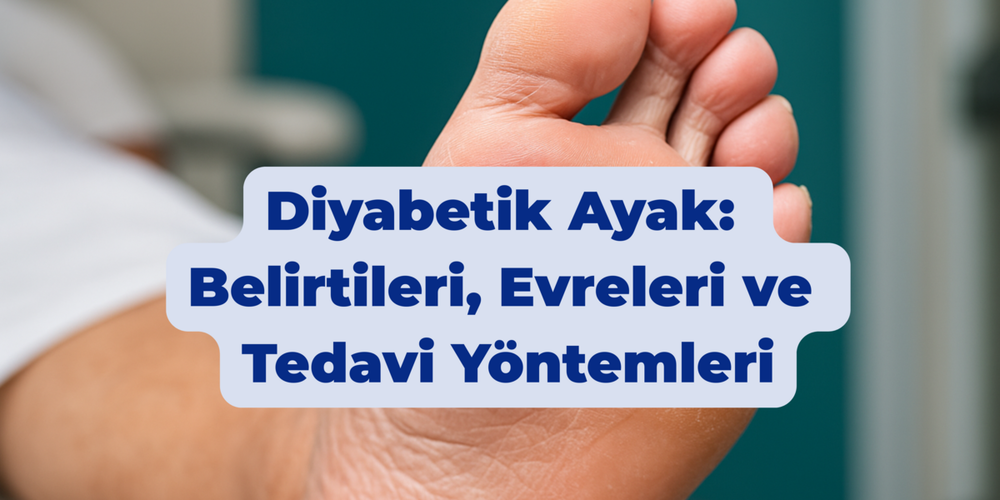 Diyabetik Ayak: Belirtileri, Evreleri ve Tedavi Yöntemleri