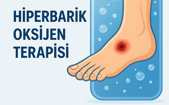 Diyabetik Ayak Tedavisinde Oksijen Tedavileri: HBOT ve Topikal Oksijen
