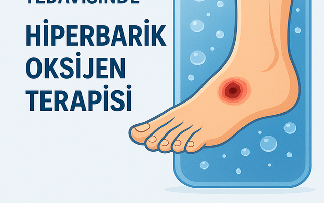 Diyabetik Ayak Tedavisinde Oksijen Tedavileri: HBOT ve Topikal Oksijen