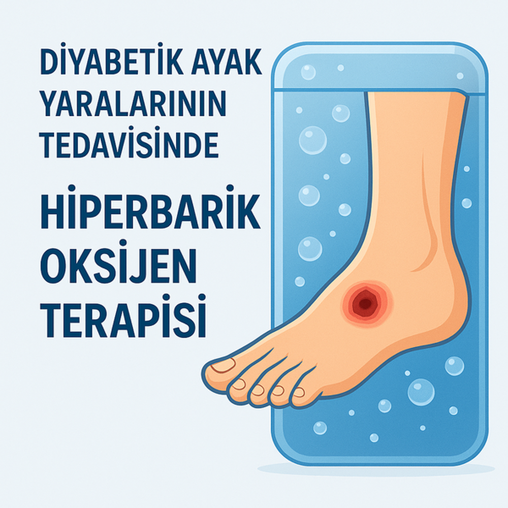 Diyabetik Ayak Tedavisinde Oksijen Tedavileri: HBOT ve Topikal Oksijen