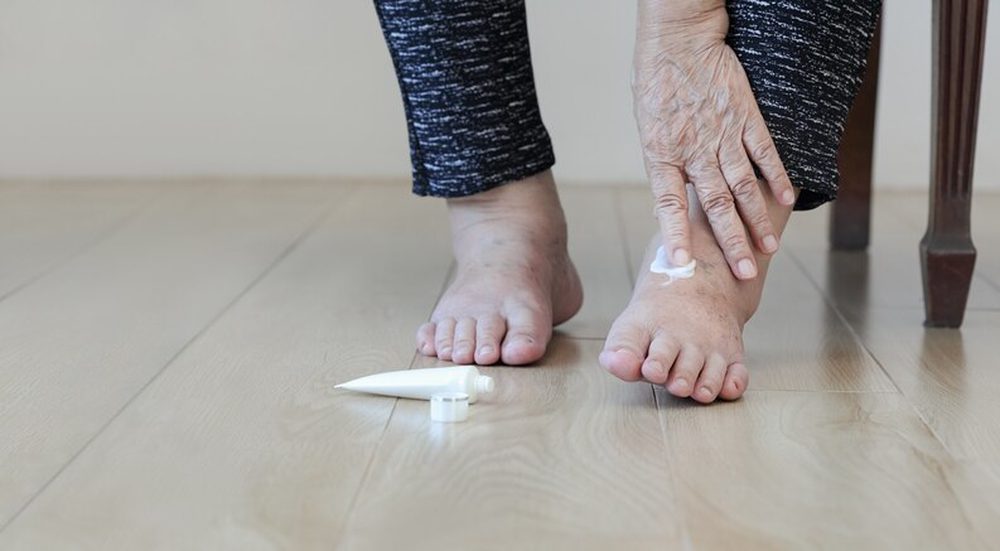 Diyabetik Ayak Yarası Olan Hastada Yara Kültürü Örnekleri Ne Zaman ve Nasıl Alınmalı?