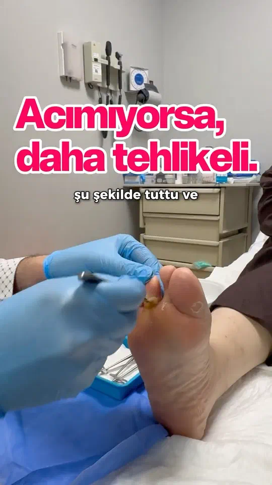 Acımıyorsa, daha tehlikeli! #diyabetikayak